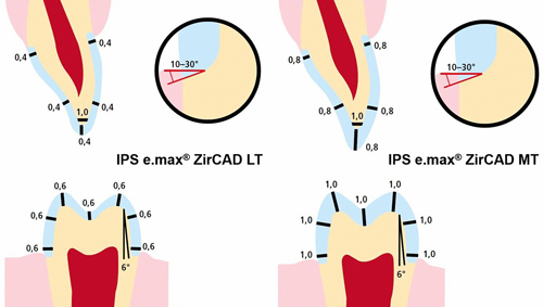 Dental Zirconia and  Keys for Clinical Success