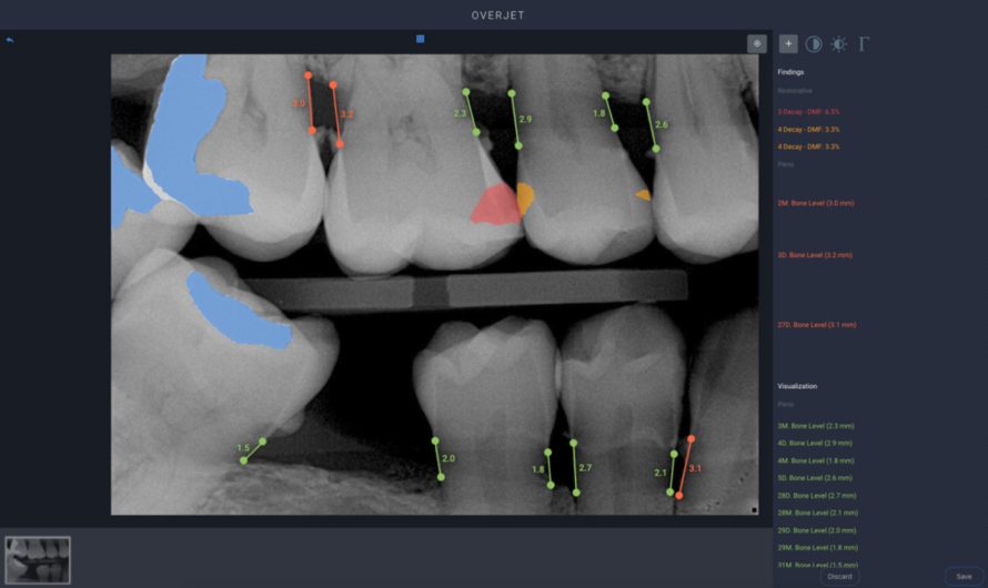 Best of Tech: Improving Dental Care with AI