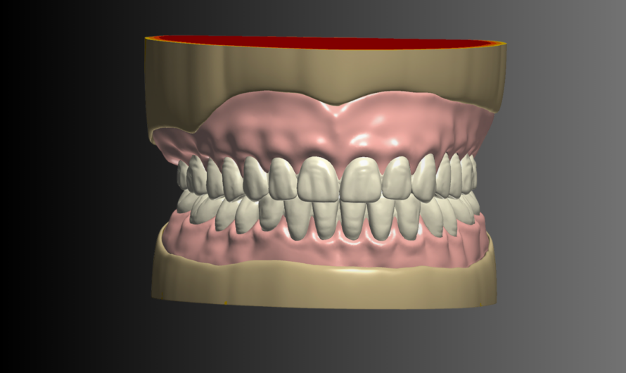 The 3D Printed Denture from NDX